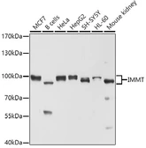 Anti-Mitofilin antibody used in Western Blot (WB). GTX33318