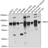 Anti-MKS1 antibody used in Western Blot (WB). GTX33319