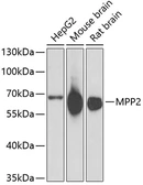 Anti-MPP2 antibody used in Western Blot (WB). GTX33322