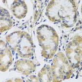 Anti-MRPL1 antibody used in IHC (Paraffin sections) (IHC-P). GTX33325