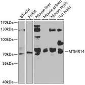Anti-MTMR14 antibody used in Western Blot (WB). GTX33332