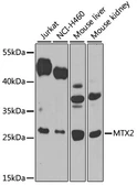 Anti-MTX2 antibody used in Western Blot (WB). GTX33333