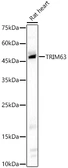 Anti-MURF1 antibody used in Western Blot (WB). GTX33334