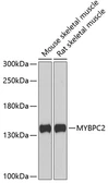 Anti-MYBPC2 antibody used in Western Blot (WB). GTX33336