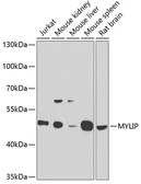 Anti-MYLIP antibody used in Western Blot (WB). GTX33337