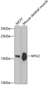 Anti-Myosin Light Chain 2 (MLC-2v) antibody used in Western Blot (WB). GTX33339