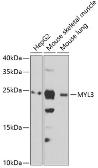 Anti-Myosin Light Chain 3 antibody used in Western Blot (WB). GTX33340