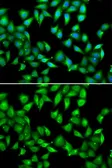 Anti-Myosin Light Chain 3 antibody used in Immunocytochemistry/ Immunofluorescence (ICC/IF). GTX33340