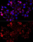 Anti-MYST2 antibody used in Immunocytochemistry/ Immunofluorescence (ICC/IF). GTX33341