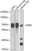 Anti-NAB2 antibody used in Western Blot (WB). GTX33342