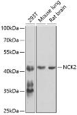 Anti-Nck beta antibody used in Western Blot (WB). GTX33346