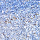 Anti-NDE1 antibody used in IHC (Paraffin sections) (IHC-P). GTX33347
