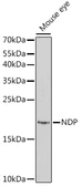 Anti-Norrin antibody used in Western Blot (WB). GTX33348
