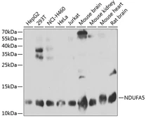 Anti-NDUFA5 antibody used in Western Blot (WB). GTX33349