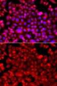 Anti-NDUFV1 antibody used in Immunocytochemistry/ Immunofluorescence (ICC/IF). GTX33351