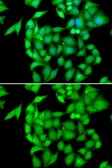 Anti-NEK3 antibody used in Immunocytochemistry/ Immunofluorescence (ICC/IF). GTX33352