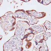 Anti-NFAT2 antibody used in IHC (Paraffin sections) (IHC-P). GTX33355