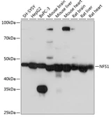 Anti-NFS1 antibody used in Western Blot (WB). GTX33356