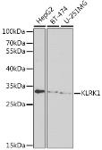 Anti-NKG2D antibody used in Western Blot (WB). GTX33358