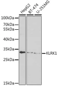 Anti-NKG2D antibody used in Western Blot (WB). GTX33358