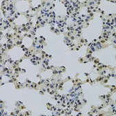 Anti-NLK antibody used in IHC (Paraffin sections) (IHC-P). GTX33359