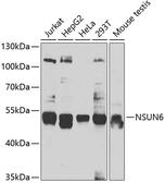 Anti-NSUN6 antibody used in Western Blot (WB). GTX33369
