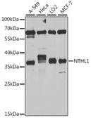 Anti-NTH1 antibody used in Western Blot (WB). GTX33370