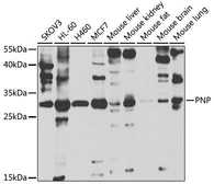 Anti-Purine nucleoside phosphorylase antibody used in Western Blot (WB). GTX33371