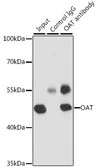 Anti-OAT antibody used in Immunoprecipitation (IP). GTX33373