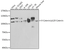 Anti-p120 Catenin antibody used in Western Blot (WB). GTX33378