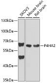 Anti-P4HA2 antibody used in Western Blot (WB). GTX33379