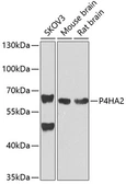 Anti-P4HA2 antibody used in Western Blot (WB). GTX33379