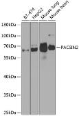 Anti-PACSIN2 antibody used in Western Blot (WB). GTX33381