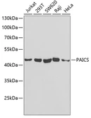 Anti-PAICS antibody used in Western Blot (WB). GTX33382