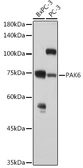 Anti-PAK6 antibody used in Western Blot (WB). GTX33383