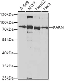 Anti-PARN antibody used in Western Blot (WB). GTX33386