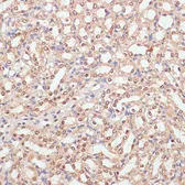 Anti-PARP antibody used in IHC (Paraffin sections) (IHC-P). GTX33387