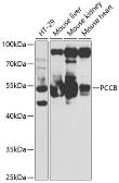 Anti-PCCB antibody used in Western Blot (WB). GTX33390