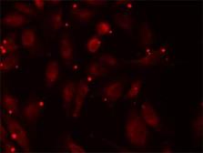 Anti-PCCB antibody used in Immunocytochemistry/ Immunofluorescence (ICC/IF). GTX33390
