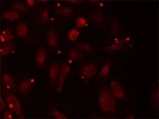 Anti-PCCB antibody used in Immunocytochemistry/ Immunofluorescence (ICC/IF). GTX33390