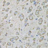 Anti-PDIA6 antibody used in IHC (Paraffin sections) (IHC-P). GTX33397