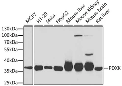 Anti-PDXK antibody used in Western Blot (WB). GTX33400