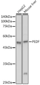 Anti-PEDF antibody used in Western Blot (WB). GTX33401