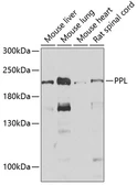 Anti-Periplakin antibody used in Western Blot (WB). GTX33403