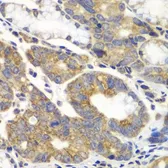 Anti-PFKM antibody used in IHC (Paraffin sections) (IHC-P). GTX33405