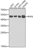 Anti-PHF6 antibody used in Western Blot (WB). GTX33408