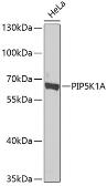 Anti-PIP5K1A antibody used in Western Blot (WB). GTX33411