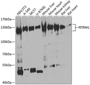Anti-PITRM1 antibody used in Western Blot (WB). GTX33412