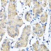 Anti-Pleckstrin antibody used in IHC (Paraffin sections) (IHC-P). GTX33414