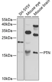 Anti-Pleiotrophin antibody used in Western Blot (WB). GTX33415